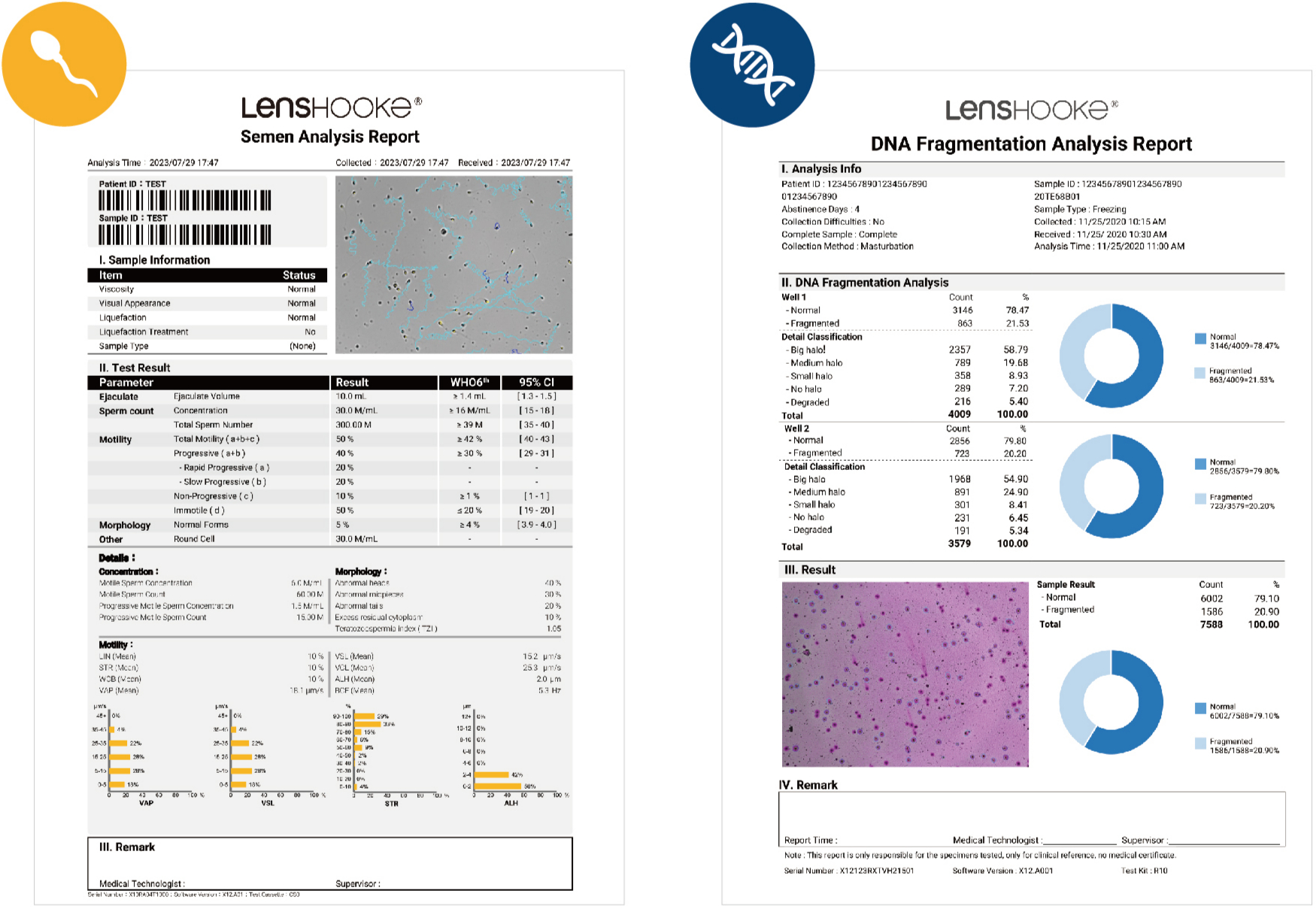 LensHooke X1 Pro rapport